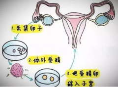 <b>试管婴儿移植周期的依据是什么？</b>