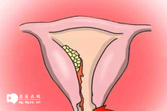 女性排卵期不排卵是什么原因